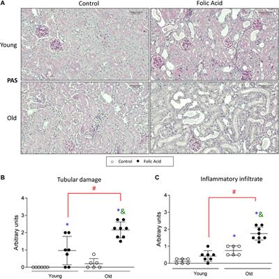 Acute Kidney Injury is Aggravated in Aged Mice by the Exacerbation of Proinflammatory Processes